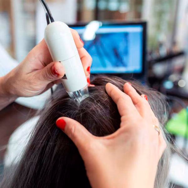 Formação Scalp Hair Therapy Profissional 1 Formação Scalp Hair Therapy Profissional